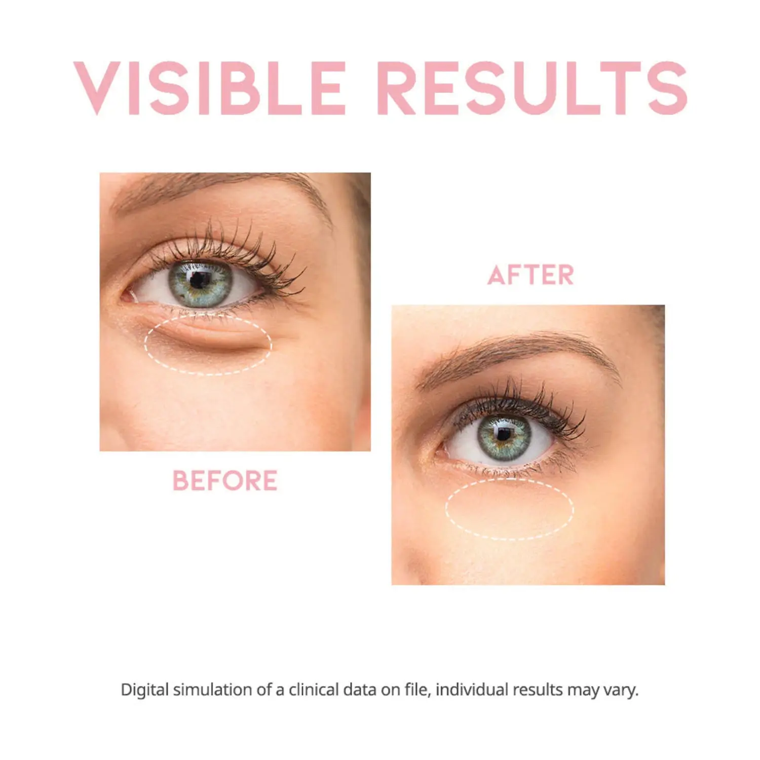 Miniatuur 4